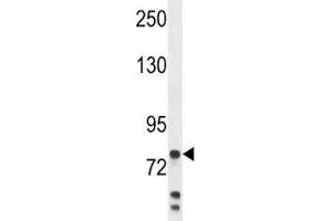 Anti-Myeloperoxidase antibody western blot analysis in MDA-MB231 lysate. (Myeloperoxidase Antikörper  (AA 420-448))
