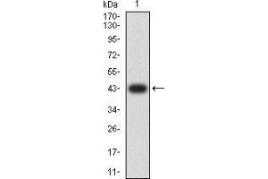 Western blot analysis using CD44 mAb against human CD44 (AA: extra 36-194) recombinant protein. (CD44 Antikörper  (AA 36-194))