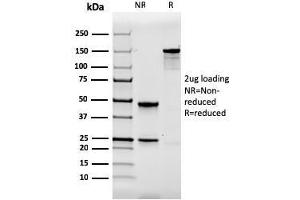 SDS-PAGE Analysis Purified Calbindin 1 Mouse Monoclonal Antibody (CALB1/2364). (CALB1 Antikörper  (AA 7-96))