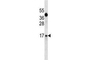 IGF1 antibody western blot analysis in A549 lysate. (IGF1 Antikörper  (AA 115-144))