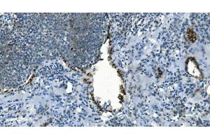 IHC analysis of IDH2 using anti-IDH2 antibody (ABIN7602786).