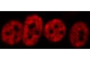 ABIN6266456 staining HeLa  cells by IF/ICC.