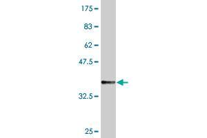 Western Blotting (WB) image for anti-TAP Binding Protein-Like (TAPBPL) (AA 23-121) antibody (ABIN565814)