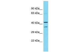 Host:  Rabbit  Target Name:  Dmbx1  Sample Type:  Rat Pancreas lysates  Antibody Dilution:  1. (DMBX1 Antikörper  (Middle Region))