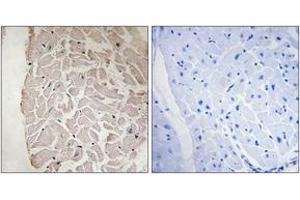 Immunohistochemistry analysis of paraffin-embedded human heart tissue, using Collagen VI alpha1 Antibody.
