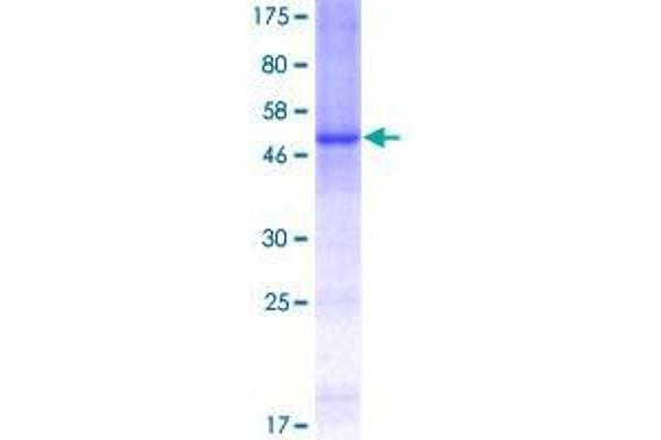 CERK Protein (AA 1-201) (GST tag)