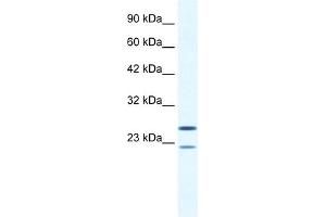 WB Suggested Anti-TRIM14 Antibody Titration:  0. (TRIM14 Antikörper  (N-Term))