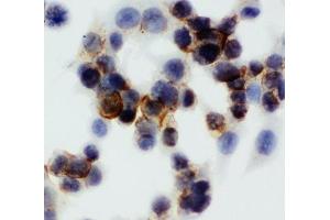 ICC: Annexin V antibody testing of HCT116 cells (Annexin V Antikörper  (AA 88-102))