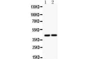 Anti- RUNX3 antibody, Western blotting All lanes: Anti RUNX3  at 0. (RUNX3 Antikörper  (Middle Region))