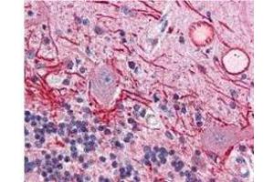 Immunohistochemistry of Mouse anti-AKT pT308 antibody. (AKT1 Antikörper  (pThr308))