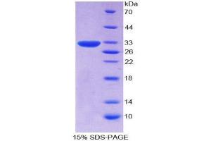 SDS-PAGE (SDS) image for CD109 (CD109) (AA 1146-1390) protein (His tag) (ABIN2124353)