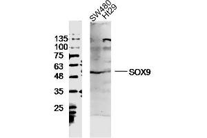 SW480 and Ht29 lysates probed with SOX9 Polyclonal Antibody, unconjugated  at 1:300 overnight at 4°C followed by a conjugated secondary antibody at 1:10000 for 90 minutes at 37°C. (SOX9 Antikörper  (AA 121-220))