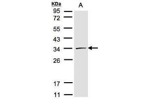 WB Image Sample(30 μg of whole cell lysate) A:293T 12% SDS PAGE antibody diluted at 1:1000 (CDK4 Antikörper)