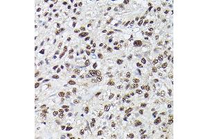 Immunohistochemistry of paraffin-embedded Human lung using SRSF2 antibody (ABIN1682677, ABIN3017915, ABIN3017916, ABIN5664377 and ABIN6220303) at dilution of 1:100 (40x lens). (SRSF2 Antikörper  (AA 1-75))