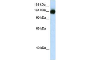 Western Blotting (WB) image for anti-Timeless Homolog (TIMELESS) antibody (ABIN2461712) (TIMELESS Antikörper)