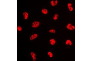 Immunofluorescent analysis of Estrogen Receptor alpha (pS106) staining in MCF7 cells. (Estrogen Receptor alpha Antikörper  (pSer106))