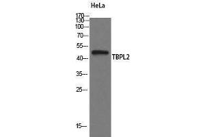 Western Blotting (WB) image for anti-TATA Box Binding Protein Like 2 (Tbpl2) (Internal Region) antibody (ABIN3177636) (Tbpl2 Antikörper  (Internal Region))