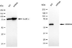 Western blotting analysis using catalase antibody (ABIN7797919). (Rekombinanter Catalase Antikörper)