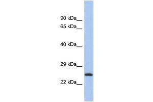 Western Blotting (WB) image for anti-Chromosome 9 Open Reading Frame 173 (C9ORF173) (N-Term) antibody (ABIN2786549) (C9ORF173 Antikörper  (N-Term))