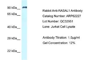Western Blotting (WB) image for anti-RAS Protein Activator Like 1 (GAP1 Like) (RASAL1) (C-Term) antibody (ABIN2789073) (RASAL1 Antikörper  (C-Term))