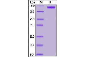 Human ACE2, His Tag on SDS-PAGE under reducing (R) condition. (ACE2 Protein (His tag))