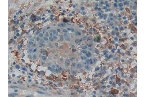 Immunohistochemistry (IHC) image for anti-Gelsolin (GSN) (AA 674-782) antibody (ABIN7442174)