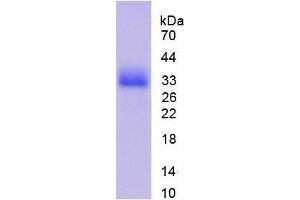SDS-PAGE analysis of Mouse CDK1 Protein. (CDK1 Protein)