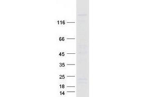 Western Blotting (WB) image for Regulator of G-Protein Signaling 3 (RGS3) (Transcript Variant 1) protein (Myc-DYKDDDDK Tag) (ABIN2730830)