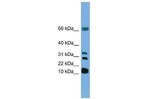 Western Blot showing LTC4S antibody used at a concentration of 1. (LTC4S Antikörper  (N-Term))