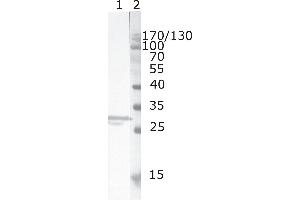 Western Blot testing of HIV-1 recombinant Nef protein. (HIV-1 Nef (AA 150-158) Antikörper)
