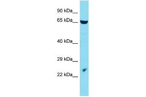 Host: Rabbit Target Name: LIN54 Sample Type: HepG2 Whole Cell lysates Antibody Dilution: 1.
