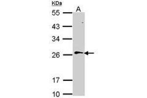 Image no. 2 for anti-RAN, Member RAS Oncogene Family (RAN) (AA 1-179) antibody (ABIN467626) (RAN Antikörper  (AA 1-179))