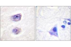 Immunohistochemistry analysis of paraffin-embedded human brain, using Tyrosine Hydroxylase (Phospho-Ser8) Antibody. (Tyrosine Hydroxylase Antikörper  (pSer8))