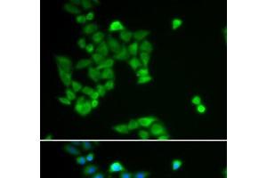 Immunofluorescence analysis of U2OS cells using PJA2 Polyclonal Antibody (PJA2 Antikörper)