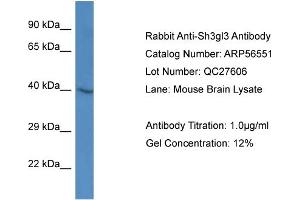 Western Blotting (WB) image for anti-Endophilin-A3 (SH3GL3) (Middle Region) antibody (ABIN2786768) (SH3GL3 Antikörper  (Middle Region))