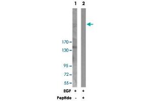 Western blot analysis of extracts from 293 cells, treated with EGF (200 ng/mL, 30 mins), using ESPL1 polyclonal antibody .