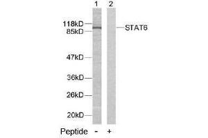 Image no. 2 for anti-Signal Transducer and Activator of Transcription 6, Interleukin-4 Induced (STAT6) (Tyr641) antibody (ABIN197184) (STAT6 Antikörper  (Tyr641))