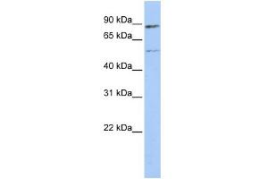 WB Suggested Anti-ESR1 Antibody Titration:  0. (Estrogen Receptor alpha Antikörper  (Middle Region))