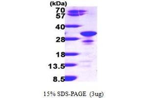 SDS-PAGE (SDS) image for Secretogranin V (7B2 Protein) (SCG5) (AA 27-212) protein (His tag) (ABIN667198) (SCG5 Protein (AA 27-212) (His tag))