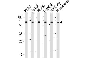 Western blot analysis of lysates from K562, Jurkat, HL-60, HepG2 cell line, human kidney, human placenta tissue(from left to right), using EPOR Antibody (C-term) (ABIN6243002 and ABIN6577698). (EPOR Antikörper  (C-Term))