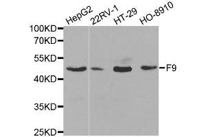 Western blot analysis of extracts of various cell lines, using F9 antibody. (Coagulation Factor IX Antikörper  (AA 29-192))