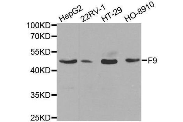Coagulation Factor IX Antikörper  (AA 29-192)