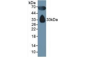 Detection of APOD in Human Serum using Polyclonal Antibody to Apolipoprotein D (APOD) (Apolipoprotein D Antikörper  (AA 21-189))