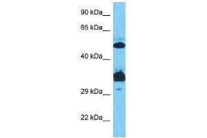 Host:  Rabbit  Target Name:  SP7  Sample Type:  Jurkat Whole Cell lysates  Antibody Dilution:  0. (SP7 Antikörper  (C-Term))