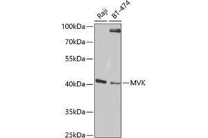 Western blot analysis of extracts of various cell lines, using MVK antibody (ABIN6128256, ABIN6144204, ABIN6144205 and ABIN6220991) at 1:1000 dilution. (MVK Antikörper  (AA 40-300))