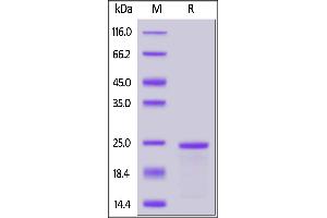 SDS-PAGE (SDS) image for Solute Carrier Family 1 Member 5 (SLC1A5) (AA 154-224) protein (His tag,TRX tag) (ABIN7013365)
