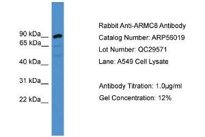 WB Suggested Anti-ARMC8  Antibody Titration: 0. (ARMC8 Antikörper  (N-Term))