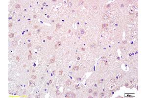 Formalin-fixed and paraffin embedded rat brain labeled with Rabbit Anti ROR1/ROR alpha Polyclonal Antibody, Unconjugated (ABIN1387717) at 1:200 followed by conjugation to the secondary antibody and DAB staining (ROR1 Antikörper  (AA 301-360))