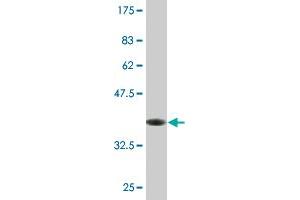 Western Blot detection against Immunogen (36. (CHST12 Antikörper  (AA 56-150))