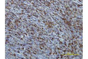 Immunostaining (ISt) image for anti-Eukaryotic Translation Initiation Factor 2B, Subunit 2 Beta, 39kDa (EIF2B2) (AA 1-351) antibody (ABIN563870)